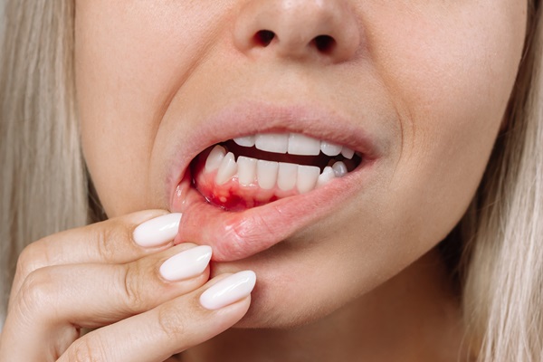 Exploring the Role of Ozone Therapy in Gum Disease Treatment