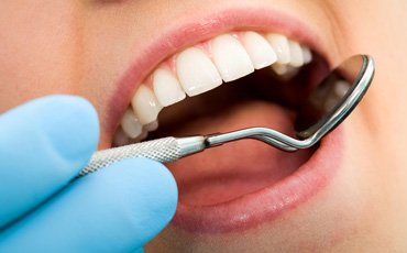 How Dentists Diagnose and Treat Oral Submucous Fibrosis