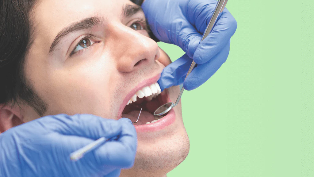 How Dentists Use SDF for Arresting Root Surface Caries in Seniors