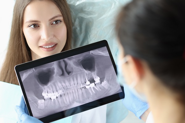 How Dentists Repair Horizontal Root Fractures: Modern Solutions