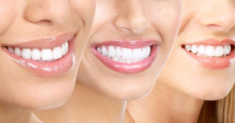 The Importance of Digital Mock-Ups in Smile Design