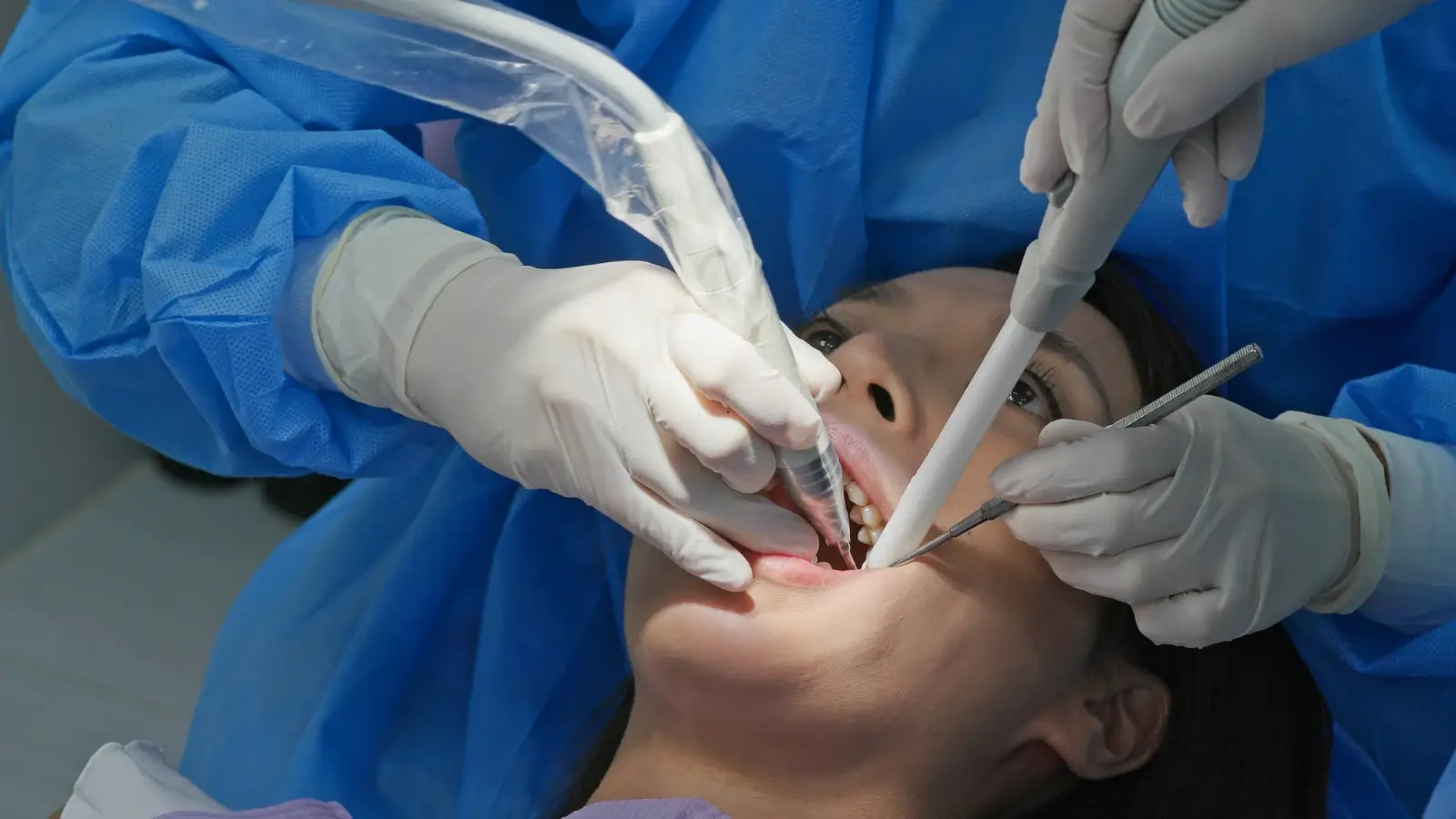 The Role of Bioceramics in Modern Root Canal Treatments