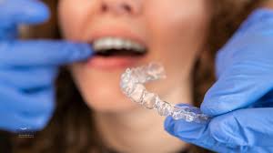 The Science Behind Vibration Therapy for Accelerating Orthodontic Treatment