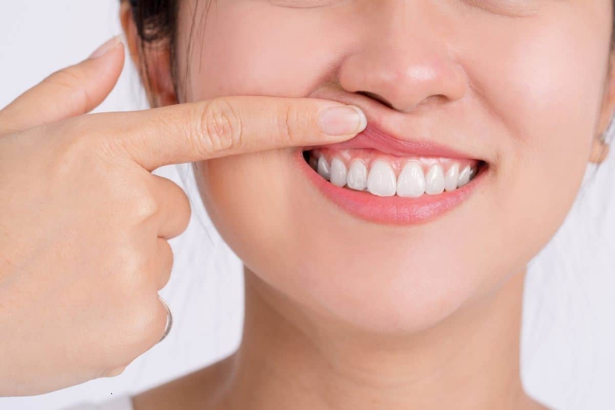 Treating Advanced Gum Disease in Diss: What You Need to Know