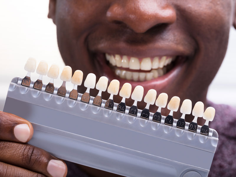 How Dental Bridges Can Close Gaps and Improve Your Bite
